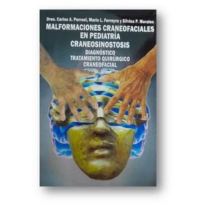 MALFORMACIONES CRANEOFACIALES EN PEDIATRIA