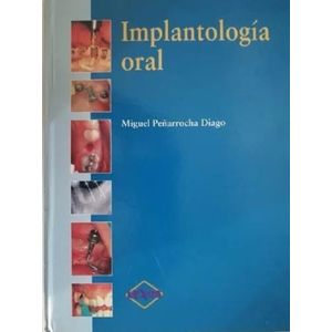 IMPLANTOLOGIA ORAL - MIGUEL PEÑARROCHA DIAGO